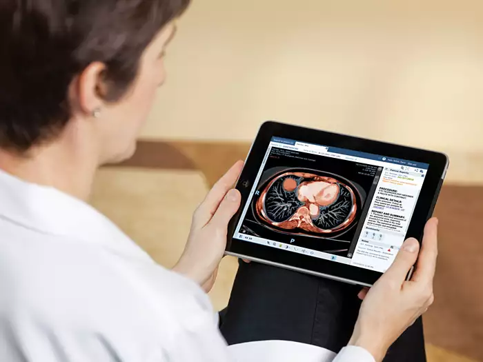 Imágenes médicas en el celular