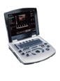 ECM lanza el nuevo ecógrafo a color Doppler ECM Exagyne