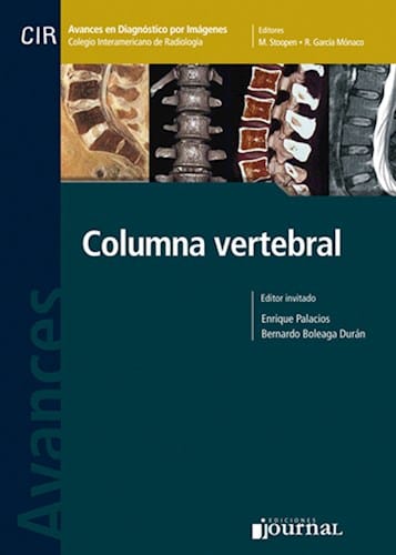 CIR: Avances en Diagnóstico por Imágenes Columna Vertebral Columna Vertebral