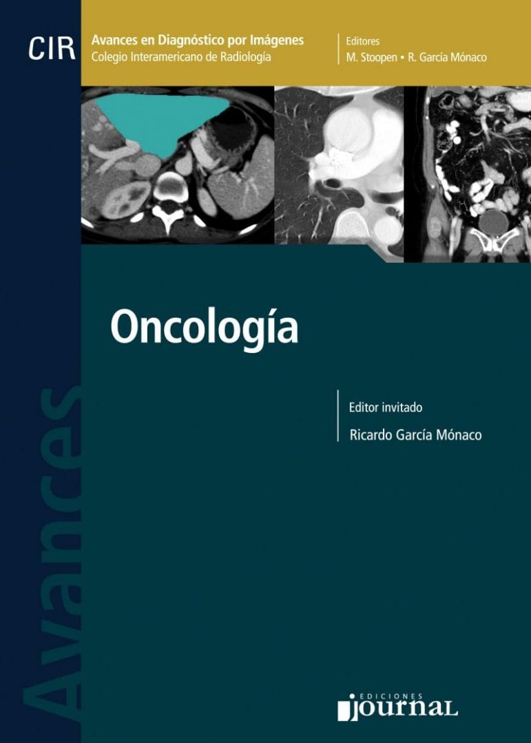 Oncología Serie Avances en Diagnóstico por imágenes CIR Oncología