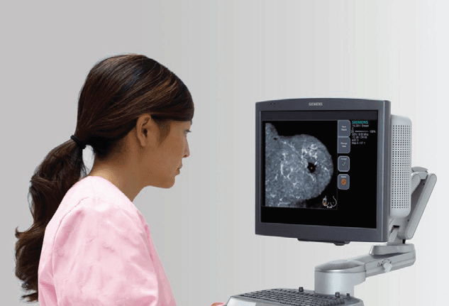Siemens presenta nuevos equipos de diagnóstico por imagen Siemens Mammomat
