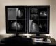 Fujifilm presenta su nueva estación de trabajo para imágenes de mamografía (BIDW)