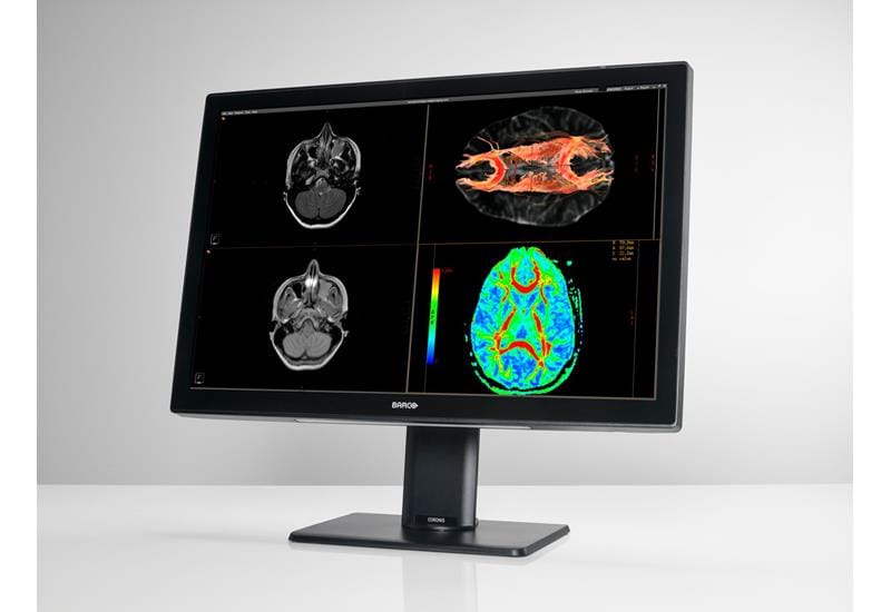 Barco lanza una nueva generación de monitores que permitirá a los radiólogos leer más estudios de forma más cómoda