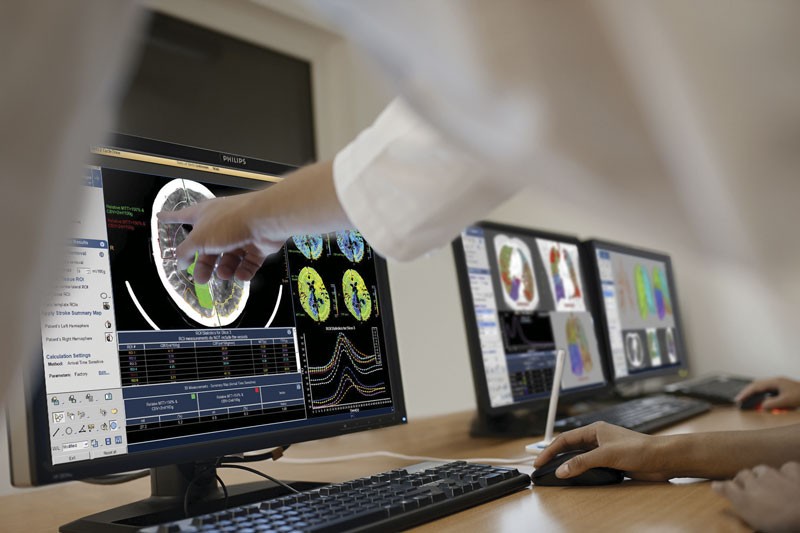 Philips - IntelliSpace Portalc 9_Advancing-care Neurology