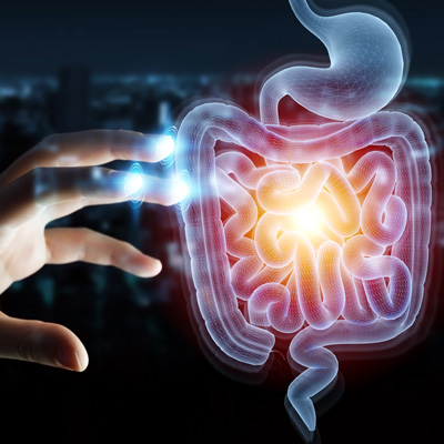 Intususcepción entérica como manifestación inicial en pacientes con Enfermedad de Crohn Enfermedad de Crohn