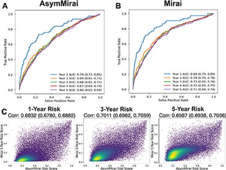 Figura 5. Comparación del rendimiento de Mirai y AsymMirai en mamografías de detección de validación del conjunto de datos de imágenes EMory BrEast (EMBED). (A) Curvas de características operativas del receptor (ROC) de predicción del riesgo de cáncer de mama de AsymMirai de 1 a 5 años y valores del área bajo la curva (AUC), con IC del 95% entre paréntesis. (B) Curvas ROC y valores de AUC de predicción del riesgo de cáncer de mama de Mirai a 1 a 5 años, con los IC del 95 % entre paréntesis. Los CI de AUC para AsymMirai y Mirai se superponen para cada año. (C) Los gráficos de densidad muestran la correlación de predicción para AsymMirai y Mirai con riesgo de 1, 3 y 5 años. Se omiten los riesgos de 2 y 4 años porque las predicciones son las mismas que las de los riesgos de 3 y 5 años, respectivamente.