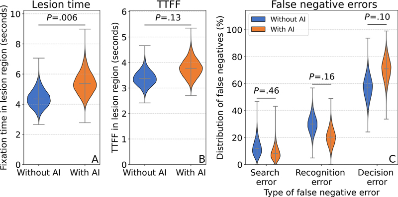 Figura 6. Los gráficos de violín muestran (A) el tiempo medio de fijación dentro de la región de la lesión para radiólogos que leen sin y con apoyo de inteligencia artificial (IA); (B) el tiempo medio hasta la primera fijación (TTFF) dentro de la región de la lesión en comparación con los radiólogos que leen sin y con apoyo de IA; y (C) las tasas medias de búsqueda, reconocimiento y error de decisión entre los casos de falsos negativos en comparación con los radiólogos que leen sin y con apoyo de IA.