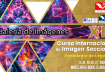 El CIIS en Imágenes