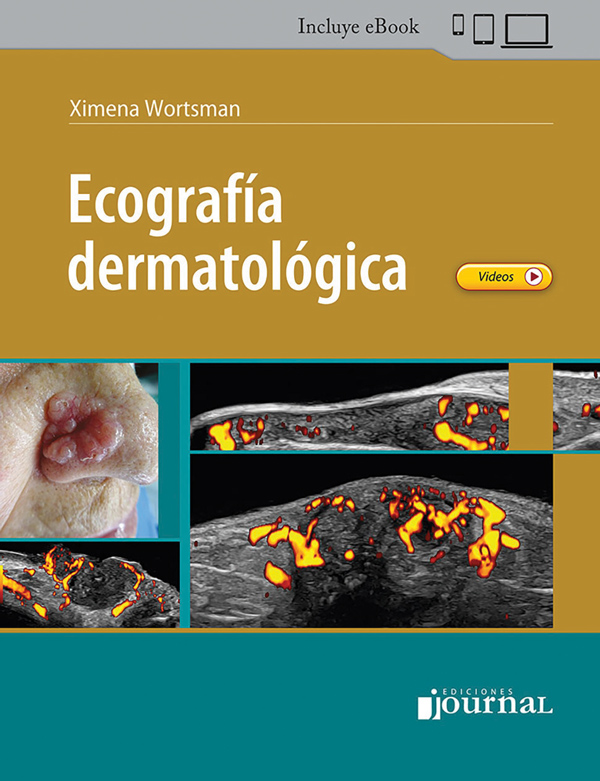 Ecografía Dermatológica