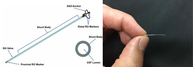 Figura 2. El dispositivo eShunt real: un fino cuerpo tubular de 35 mm con un anclaje en su extremo distal.
